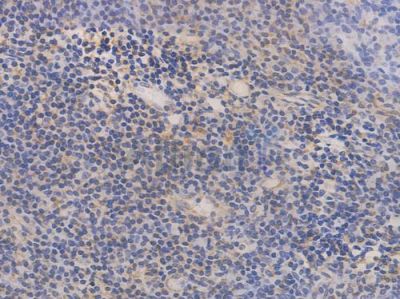 MMP3 Recombinant Rabbit mAb - BF3157 at 1/100 staining Human tonsil tissue by IHC-P.