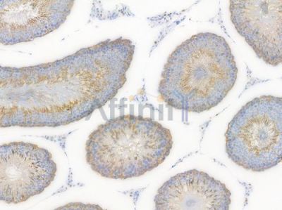 Hexokinase II Recombinant Rabbit mAb - BF3161 at 1/100 staining Rat testicular tissue by IHC-P.