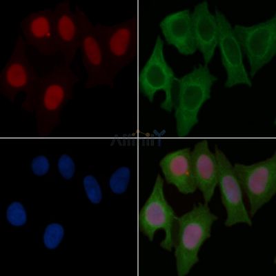 Phospho-c-Myc (Ser62) Recombinant Rabbit mAb - BF3164 staining Hela cells(30min of UV treatment) by IF/ICC.