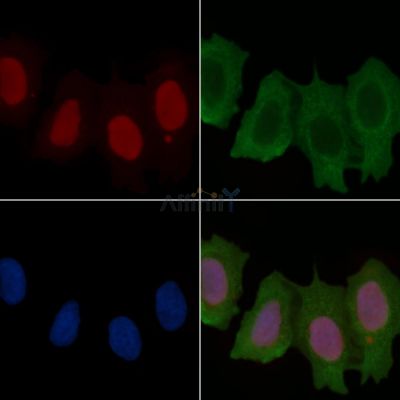 c-Myc Recombinant Rabbit mAb - BF3165 staining Hela cells(30min of UV treatment) by IF/ICC.