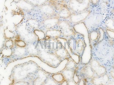 ATF6 Recombinant Rabbit mAb - BF3167 at 1/100 staining Human renal tissue by IHC-P.