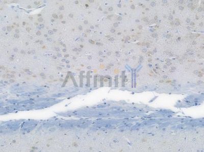 ATF6 Recombinant Rabbit mAb - BF3167 at 1/100 staining Rat brain tissue by IHC-P.