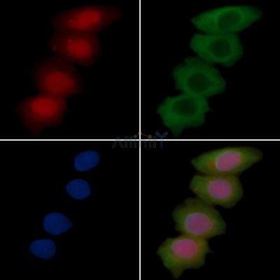 IRS1 Recombinant Rabbit mAb - BF3168 staining Hela cells(30min of UV treatment) by IF/ICC.