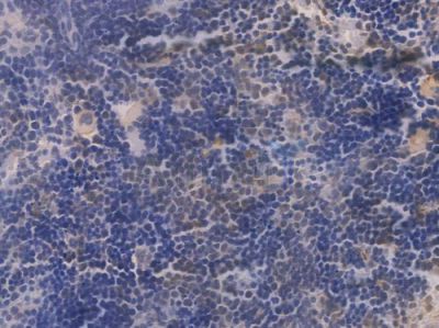 CHOP Recombinant Rabbit mAb - BF3176 at 1/100 staining Mouse spleen tissue by IHC-P.