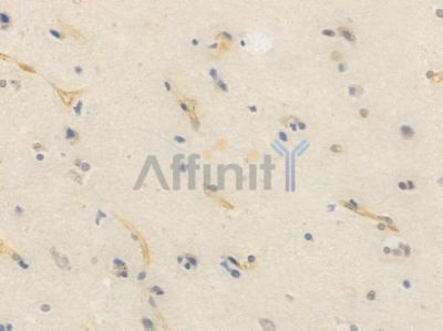 CHOP Recombinant Rabbit mAb - BF3176 at 1/100 staining Human brain tissue by IHC-P.