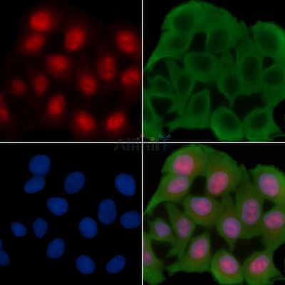 FGF2 Recombinant Rabbit mAb - BF3179 staining Hela cells(30min of UV treatment) by IF/ICC.