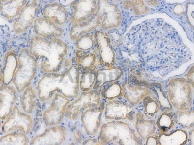 TOMM20 Recombinant Rabbit mAb - BF3180 at 1/100 staining Human renal tissue by IHC-P.