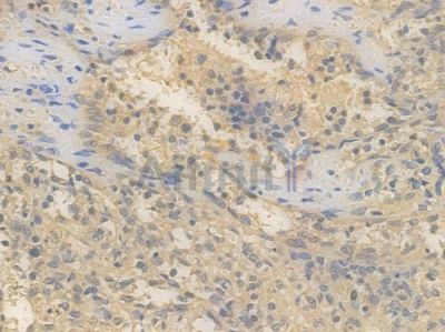 Calnexin Recombinant Rabbit mAb - BF3184 at 1/100 staining Human spleen tissue by IHC-P.