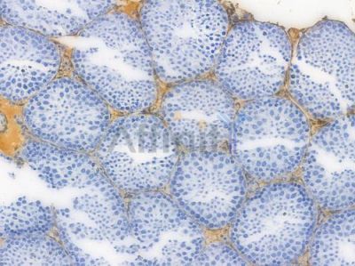 PDGF Receptor alpha Recombinant Rabbit mAb - BF3190 at 1/100 staining Mouse testicular tissue by IHC-P.