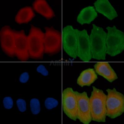 NG2 Recombinant Rabbit mAb - BF3201 staining Hela cells(30min of UV treatment) by IF/ICC.