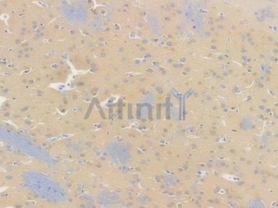 PSD95 Recombinant Rabbit mAb - BF3202 at 1/100 staining Rat brain tissue by IHC-P.