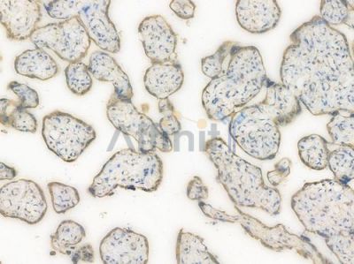 CALR Recombinant Rabbit mAb - BF3219 at 1/100 staining Human placental tissue by IHC-P.