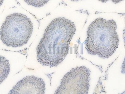 Phospho-eIF2 alpha (Ser51) Recombinant Rabbit mAb - BF3233 at 1/100 staining Rat testicular tissue by IHC-P.