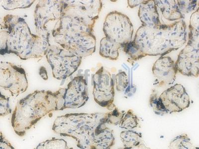 GRP78 Recombinant Rabbit mAb - BF3235 at 1/100 staining Human placental tissue by IHC-P.