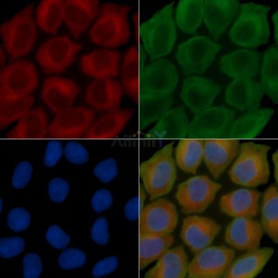 Acetyl ACC1 Recombinant Rabbit mAb - BF3250 staining Hela cells(30min of UV treatment) by IF/ICC.