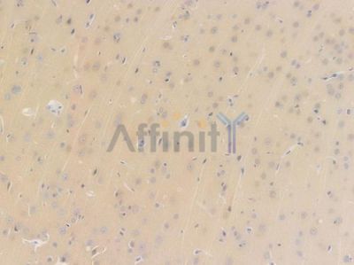 CaMKII Recombinant Rabbit mAb - BF3257 at 1/100 staining Rat brain tissue by IHC-P.