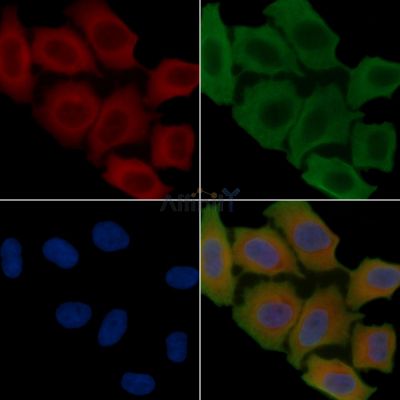 FASN Recombinant Rabbit mAb - BF3263 staining Hela cells(30min of UV treatment) by IF/ICC.