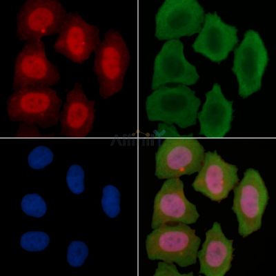 KAT3B/p300 Recombinant Rabbit mAb - BF3268 staining Hela cells(30min of UV treatment) by IF/ICC.
