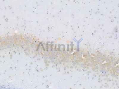 SCD1 Recombinant Rabbit mAb - BF3271 at 1/100 staining Rat brain tissue by IHC-P.
