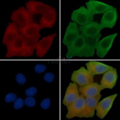 CD34 Recombinant Rabbit mAb - BF3274 staining Hela cells(30min of UV treatment) by IF/ICC.