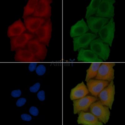 PI3 kinase P110 alpha Recombinant Rabbit mAb - BF3278 staining Hela cells(30min of UV treatment) by IF/ICC.