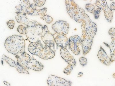IKK beta Recombinant Rabbit mAb - BF3279 at 1/100 staining Human placental tissue by IHC-P.