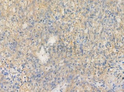 IKK beta Recombinant Rabbit mAb - BF3279 at 1/100 staining Human spleen tissue by IHC-P.