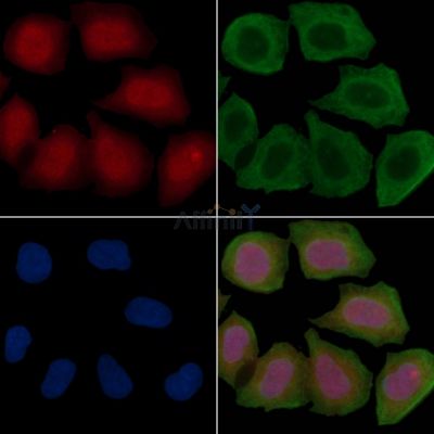 Trk B Recombinant Rabbit mAb - BF3285 staining Hela cells(30min of UV treatment) by IF/ICC.