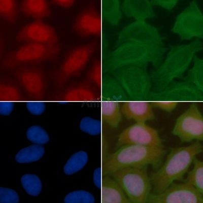 HES1 Recombinant Rabbit mAb - BF3296 staining Hela cells(30min of UV treatment) by IF/ICC.