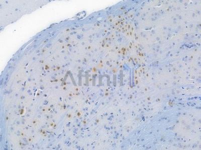 GATA3 Recombinant Rabbit mAb - BF3323 at 1/100 staining Mouse brain tissue by IHC-P.