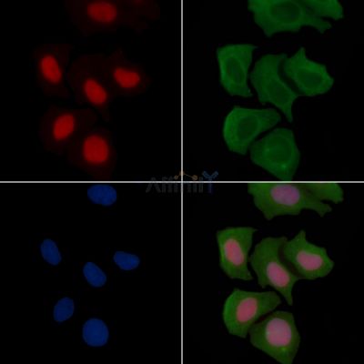 METTL3 Recombinant Rabbit mAb - BF3332 staining Hela cells(30min of UV treatment) by IF/ICC.