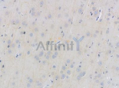 APP Recombinant Rabbit mAb - BF3335 at 1/100 staining Rat brain tissue by IHC-P.