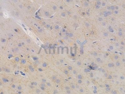 APP Recombinant Rabbit mAb - BF3335 at 1/100 staining Mouse brain tissue by IHC-P.