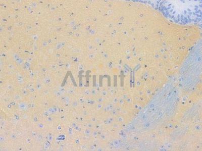 GAP43 Recombinant Rabbit mAb - BF3344 at 1/100 staining Mouse brain tissue by IHC-P.