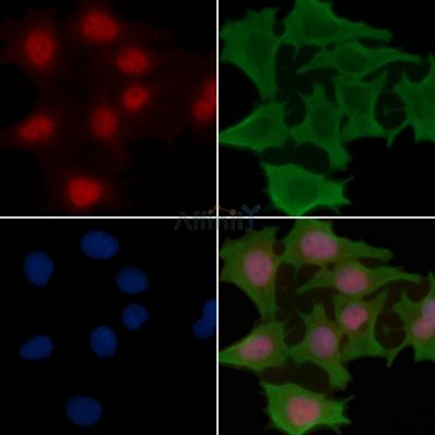 ZEB1 Recombinant Rabbit mAb - BF3349 staining Hela cells(30min of UV treatment) by IF/ICC.