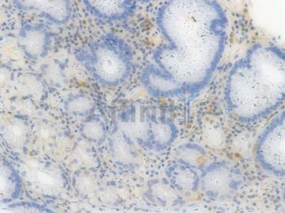 IRF5 Recombinant Rabbit mAb - BF3350 at 1/100 staining Human gastric tissue by IHC-P.