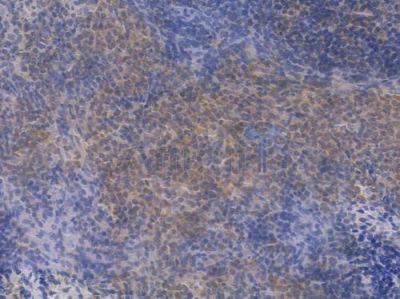 IRF5 Recombinant Rabbit mAb - BF3350 at 1/100 staining Rat spleen tissue by IHC-P.