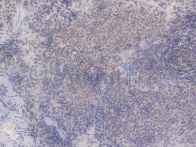CDK2 Recombinant Rabbit mAb - BF3364 at 1/100 staining Rat spleen tissue by IHC-P.