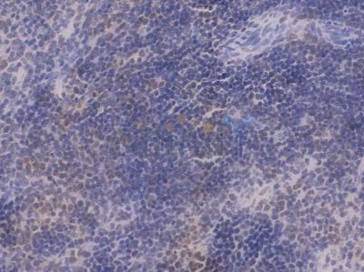 CDK2 Recombinant Rabbit mAb - BF3364 at 1/100 staining Mouse ovarian tissue by IHC-P.