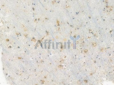 LDLR Recombinant Rabbit mAb - BF3368 at 1/100 staining Human brain tissue by IHC-P.