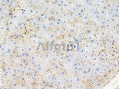 LDLR Recombinant Rabbit mAb - BF3368 at 1/100 staining Human liver tissue by IHC-P.