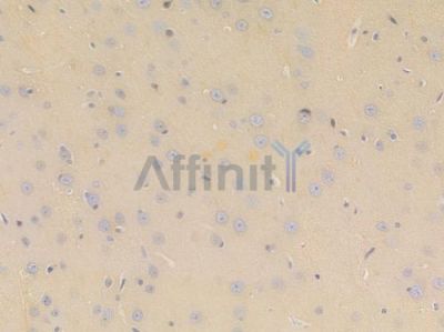 beta III Tubulin Recombinant Rabbit mAb - BF3372 at 1/100 staining Rat heart tissue by IHC-P.