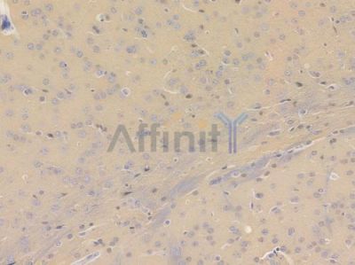 beta III Tubulin Recombinant Rabbit mAb - BF3372 at 1/100 staining Mouse brain tissue by IHC-P.