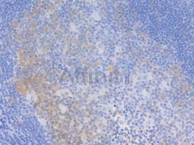CDK1/CDC2 Recombinant Rabbit mAb - BF3376 at 1/100 staining Human tonsil tissue by IHC-P.