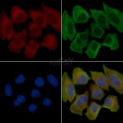 EpCAM Recombinant Rabbit mAb - BF3401 staining Hela cells(30min of UV treatment) by IF/ICC.