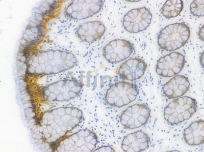 EpCAM Recombinant Rabbit mAb - BF3401 at 1/100 staining Human intestinal tissue by IHC-P.