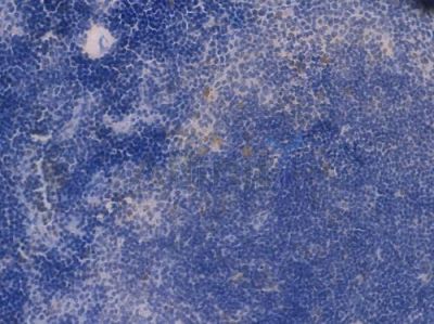NAMPT Recombinant Rabbit mAb - BF3402 at 1/100 staining Mouse spleen tissue by IHC-P.