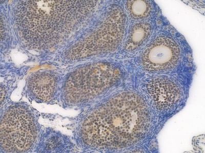 NAMPT Recombinant Rabbit mAb - BF3402 at 1/100 staining Mouse ovarian tissue by IHC-P.