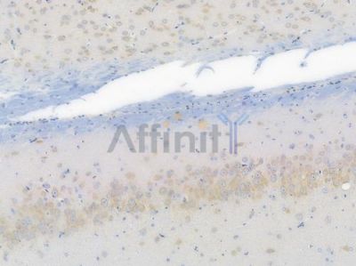 c-Met Recombinant Rabbit mAb - BF3413 at 1/100 staining Rat brain tissue by IHC-P.
