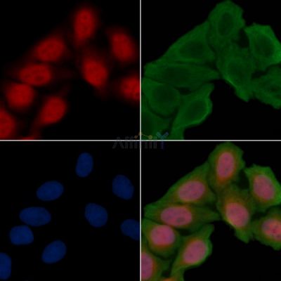 ATM Recombinant Rabbit mAb - BF3427 staining Hela cells(30min of UV treatment) by IF/ICC.